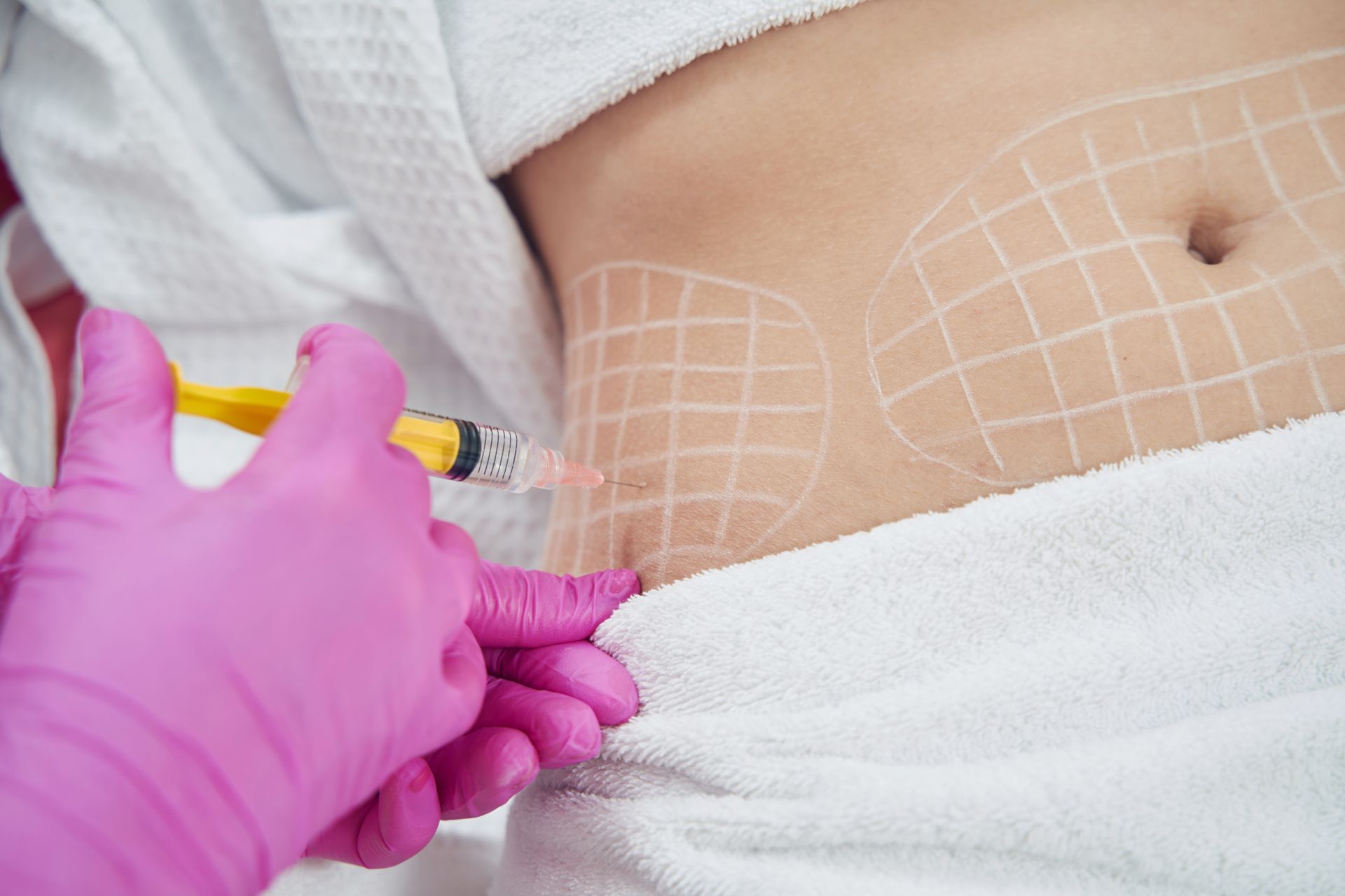 A woman is getting a cavitation treatment on her stomach.