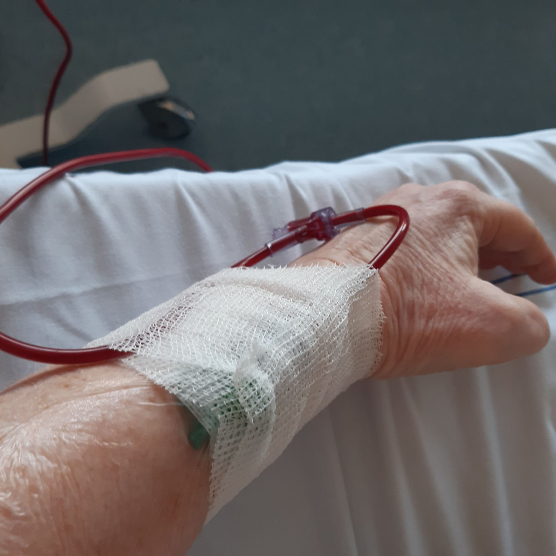Hand met aangesloten medische slang, bedekt met gaasverband, op een bed.