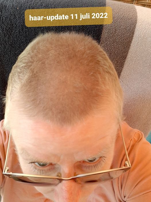 Scroll naar boven voor het begin van dit reisverslag Close-up van een persoon met dunner wordend blond haar, die naar beneden kijkt en een bril draagt. Tekst: