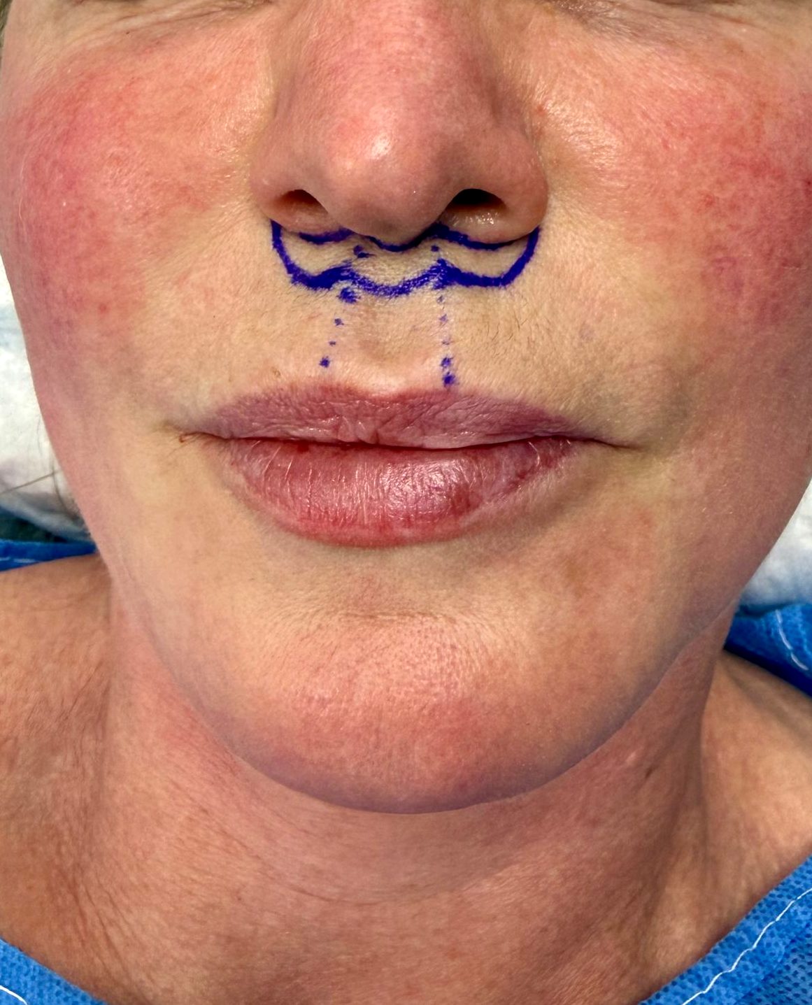 A woman wearing a pink scarf is applying lipstick to her lips