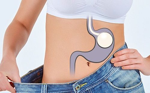 Benefits of Weight Loss and How a Gastric Balloon Helps