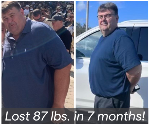 Chronos remote GLP-1 weight loss support in Texas | before and after photo of real patient results