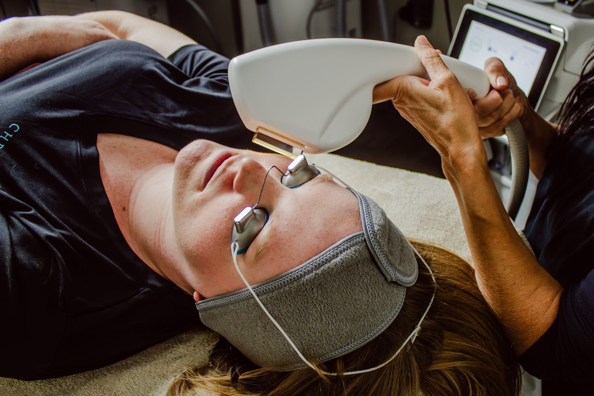 IPL Photofacial service for sun spots and age spots in Metairie | Chronos BHW
