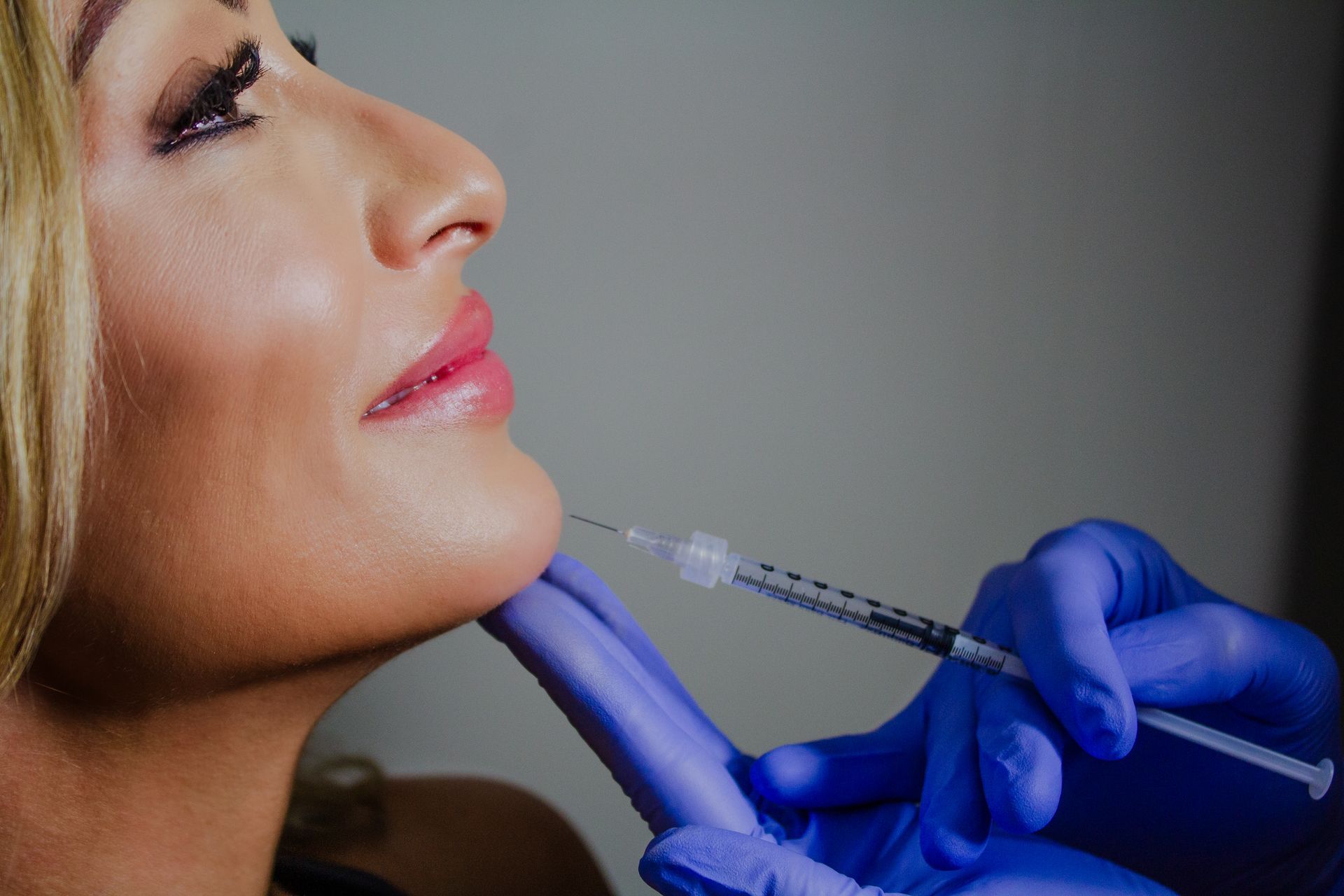 Dermal filler & hyaluronic fillers at Chronos Body Health & Wellness in Metairie, LA