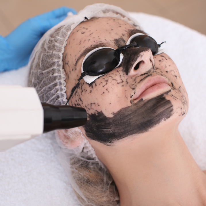 NaturaPeel treatments for treating acne | Chronos BHW in Metairie, LA