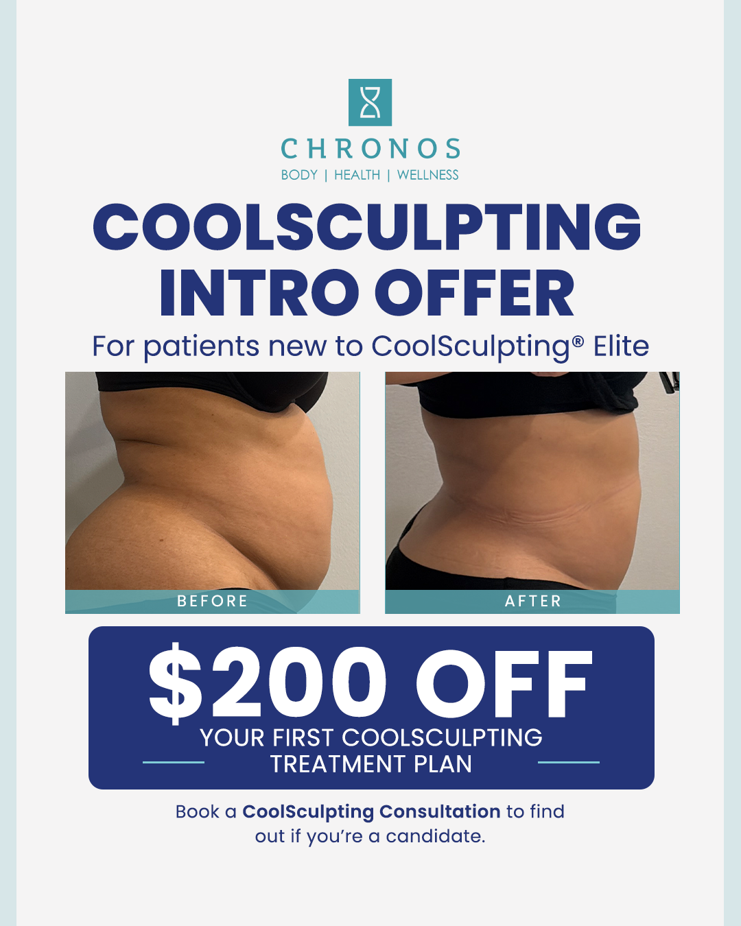 CoolSculpting Elite New Patient Offer | Chronos | Metairie