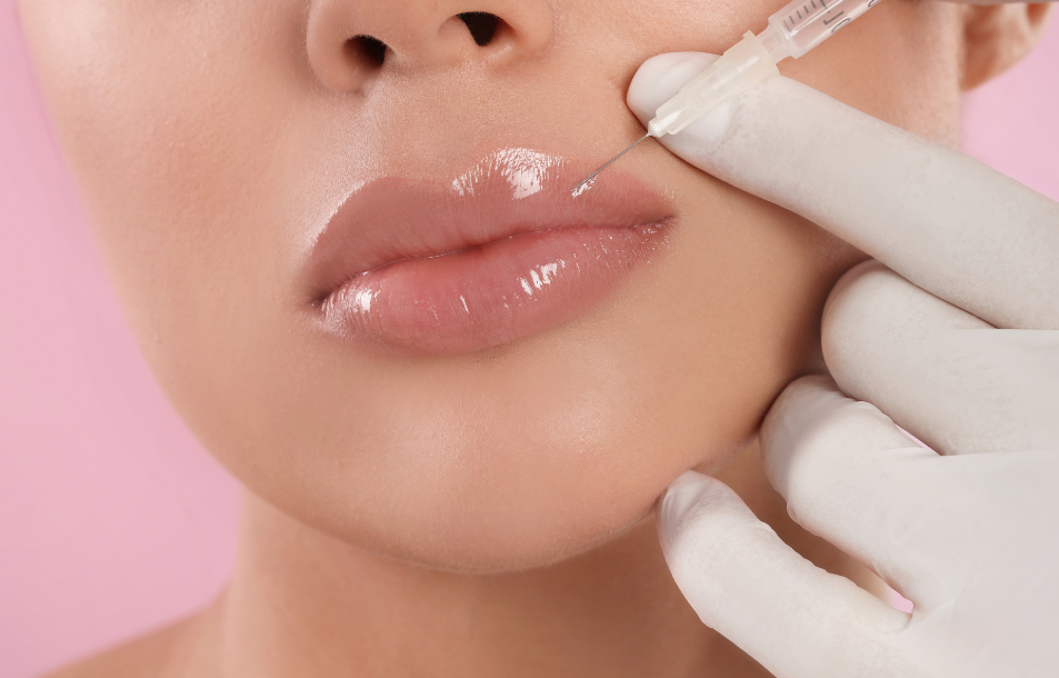 Lip filler specials in Metairie, LA | Lip filler nola | Lip filler savings | Chronos BHW