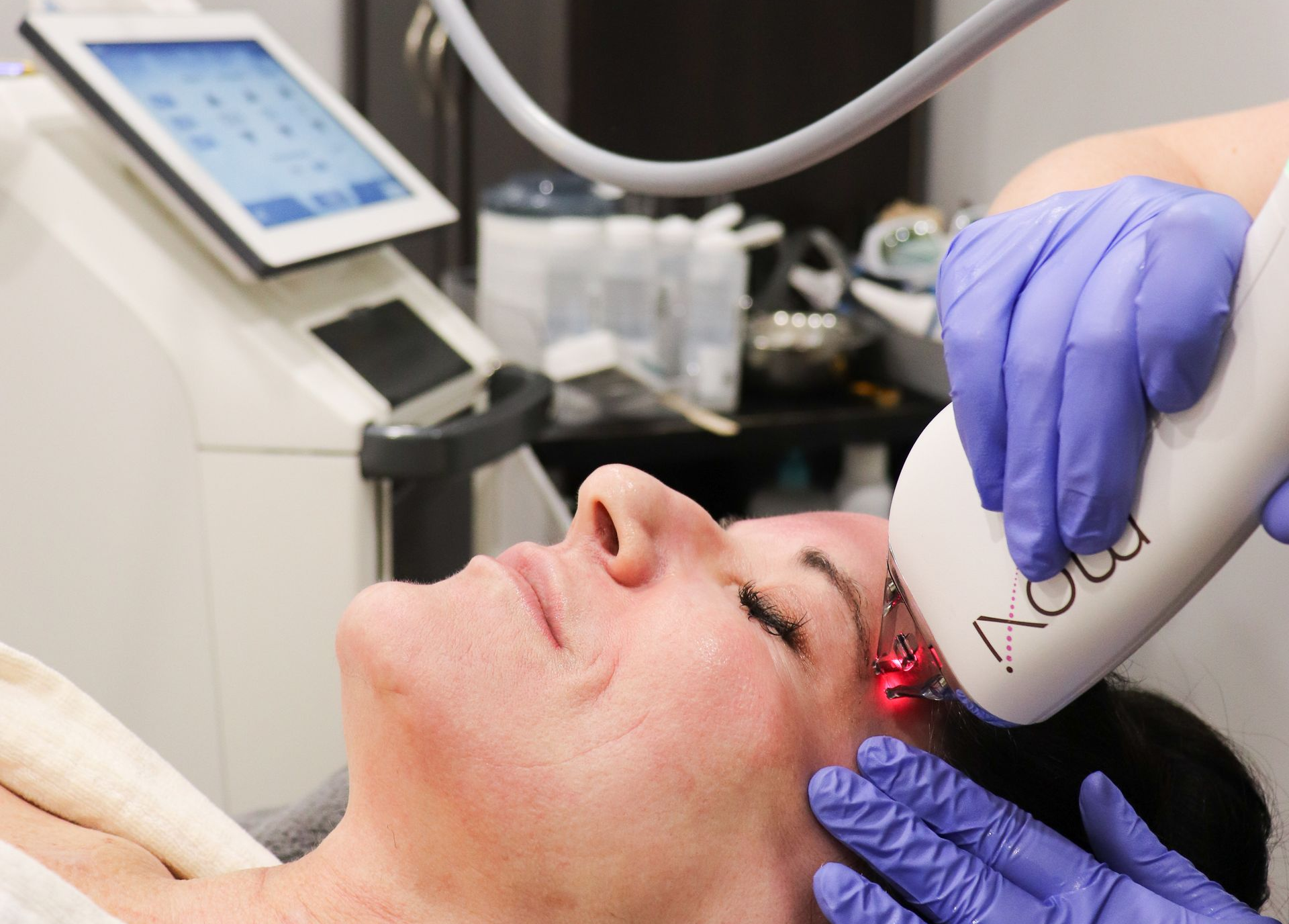 Patient receiving MOXI and BBL HEROic skin rejuvenation treatment at Chronos Body Health & Wellness 