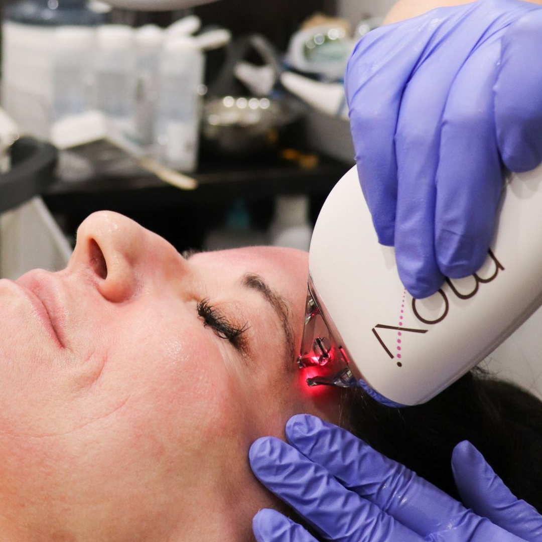 Chrome Refresh treatment for treating dark spots and brown spots | Treat hyperpigmentation at Chronos BHW