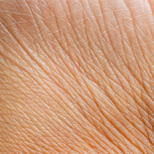 Fine line and wrinkle treatment | Anti-aging facial Metairie and New Orleans | Chronos HW