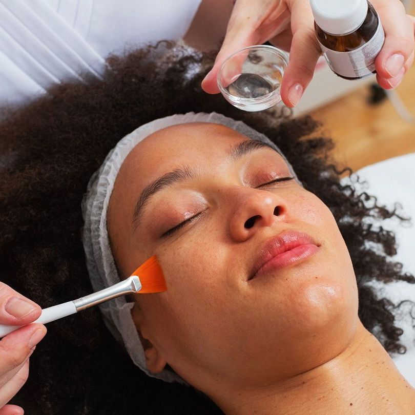 Medical grade chemical peels to treat acne and acnes scarring in Metairie | Chronos BHW