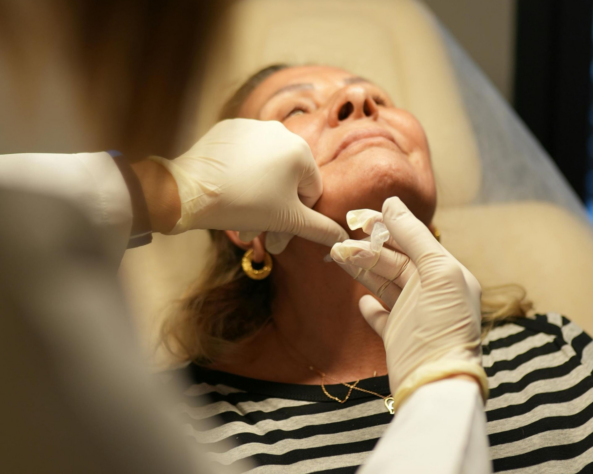 PDO Thread life | Non-invasive face lift | Mini face lift | Metairie and New Orleans | Chronos