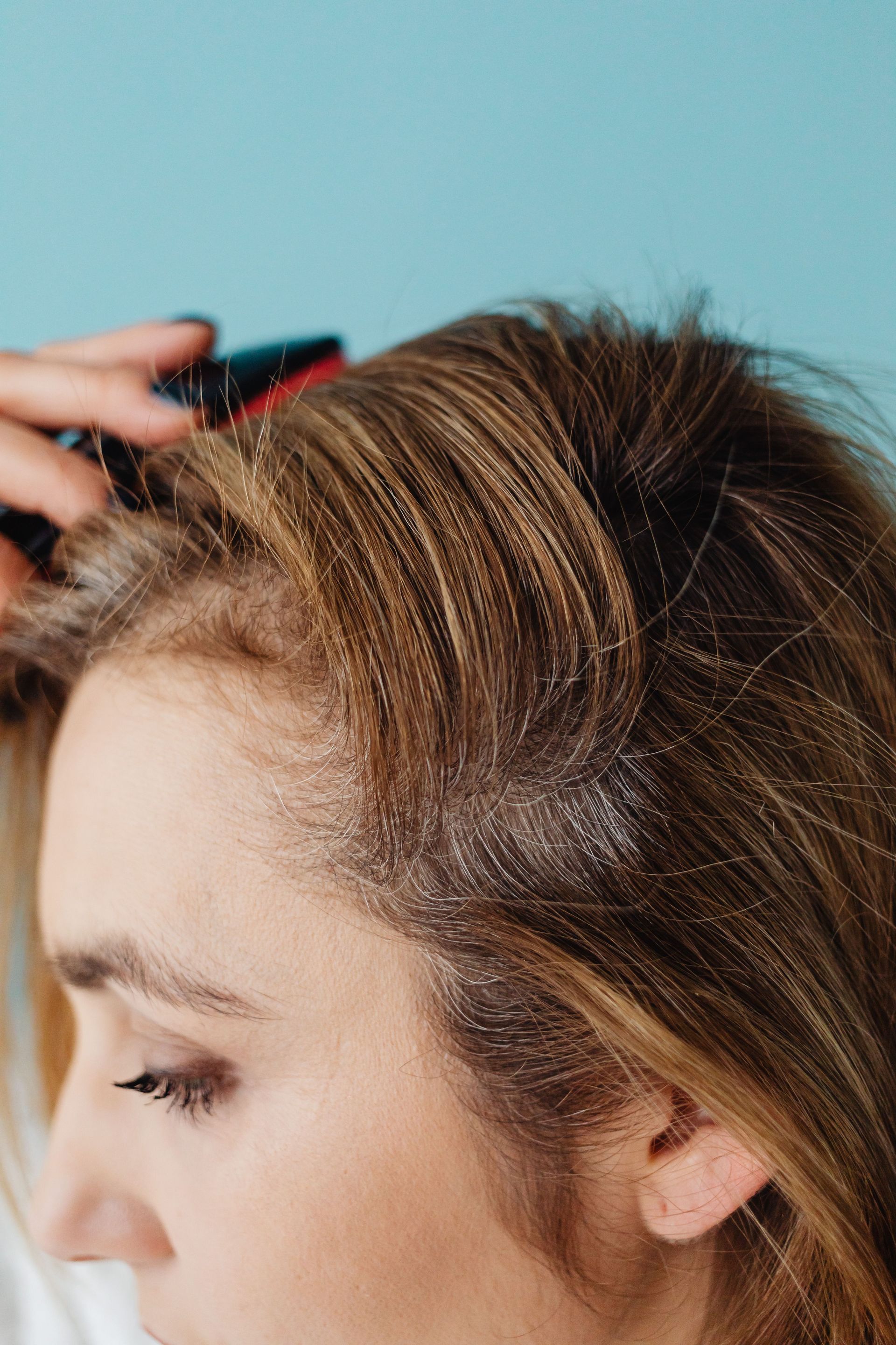 Consultation & Scalp Assessment