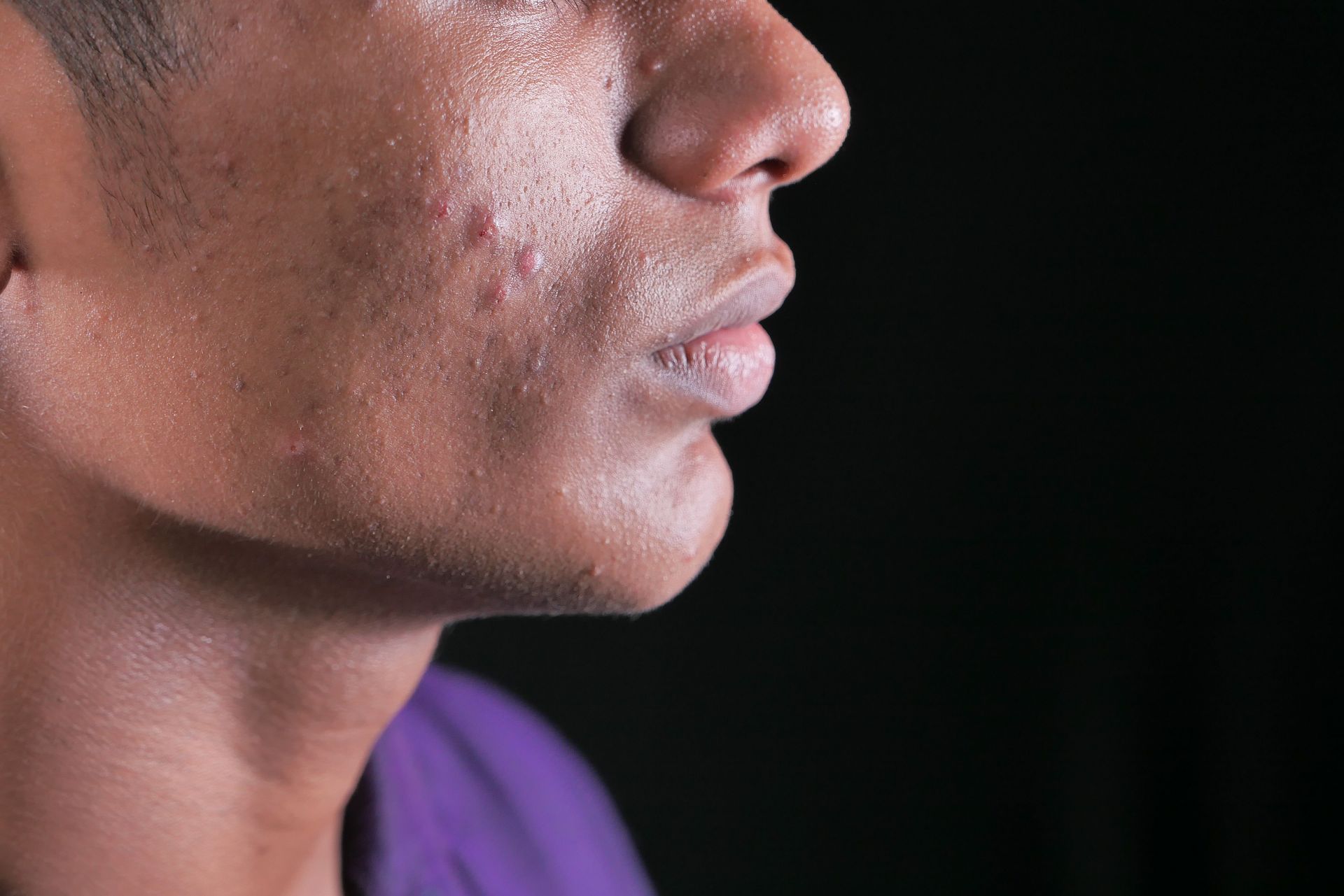 Men's laser skin treatments in Metairie | Chronos Metairie | Men's health