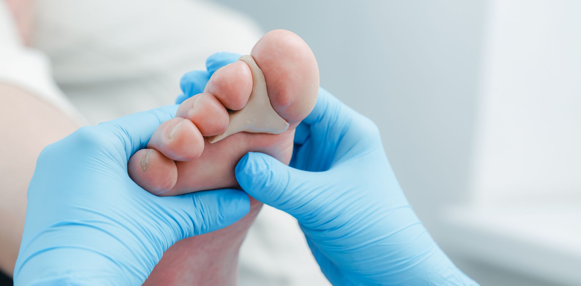 A podiatrist wearing gloves examines toes and fits a spacer to address a foot condition. A podiatrist wearing gloves examines toes and fits a spacer to address a foot condition.