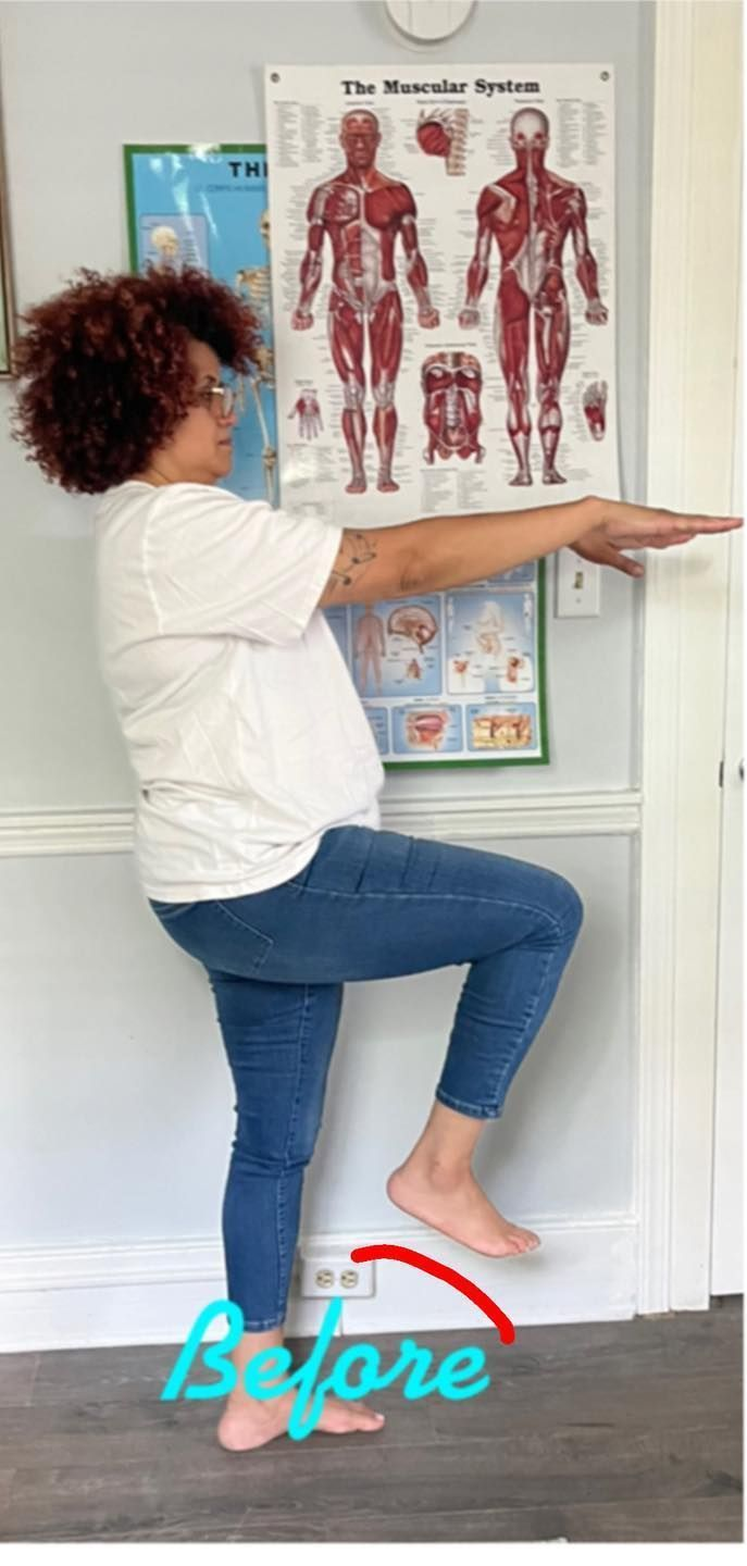 Person balancing on one leg in front of a wall anatomy chart, labeled “Before” at the bottom.