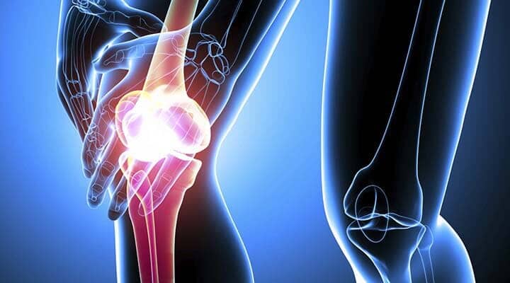 ​UNIDAD DE REUMATOLOGÍA DEL SURESTE - Dolores musculares