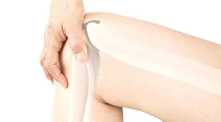 ​UNIDAD DE REUMATOLOGÍA DEL SURESTE - Fibromialgia