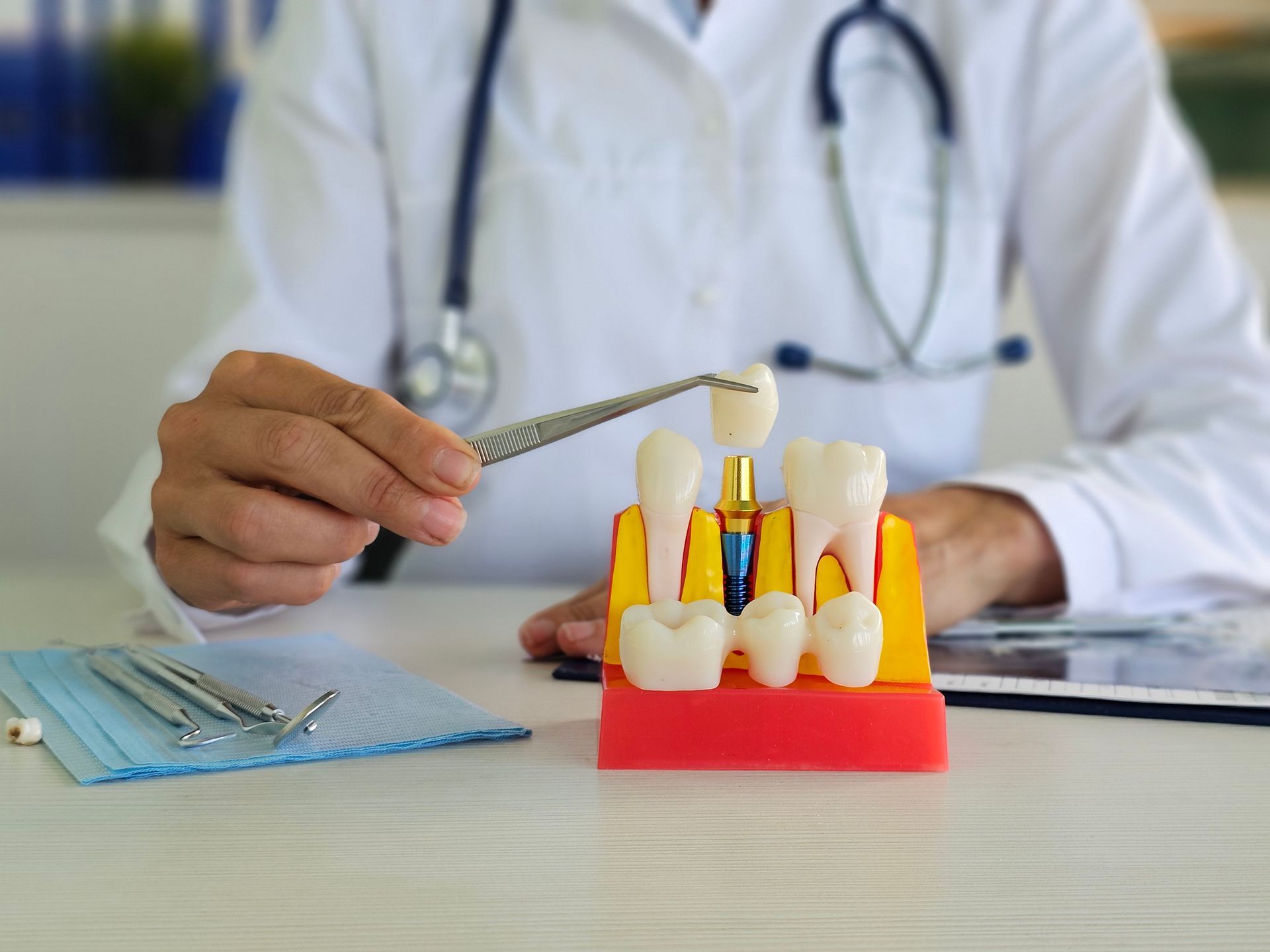 A dentist is holding a model of a dental implant.