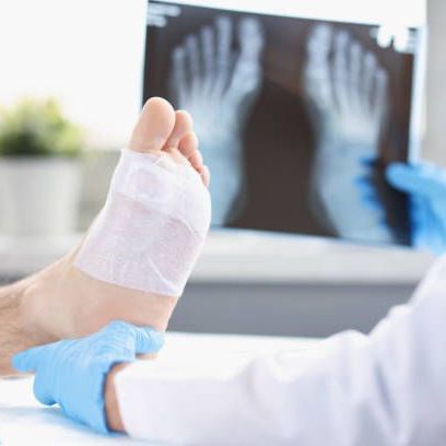 Foot on table reviewing xray