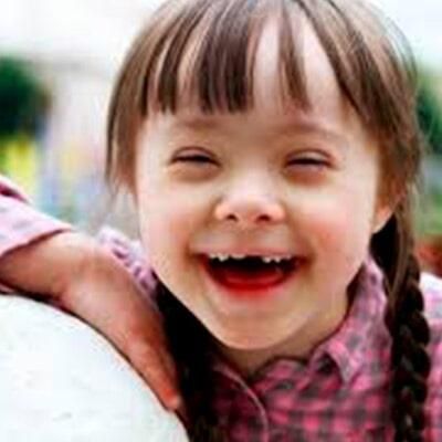 DRA. LINDA ESTUDILLO FLORES - atención a niños con sindrome de down