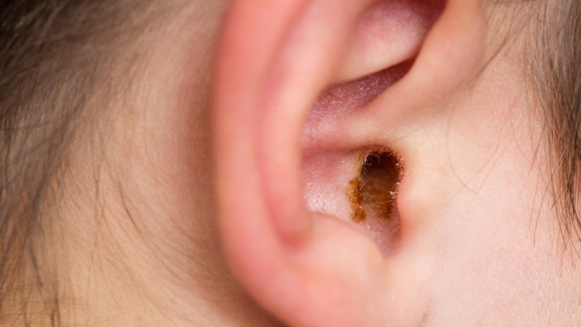 Ear wax cleaning