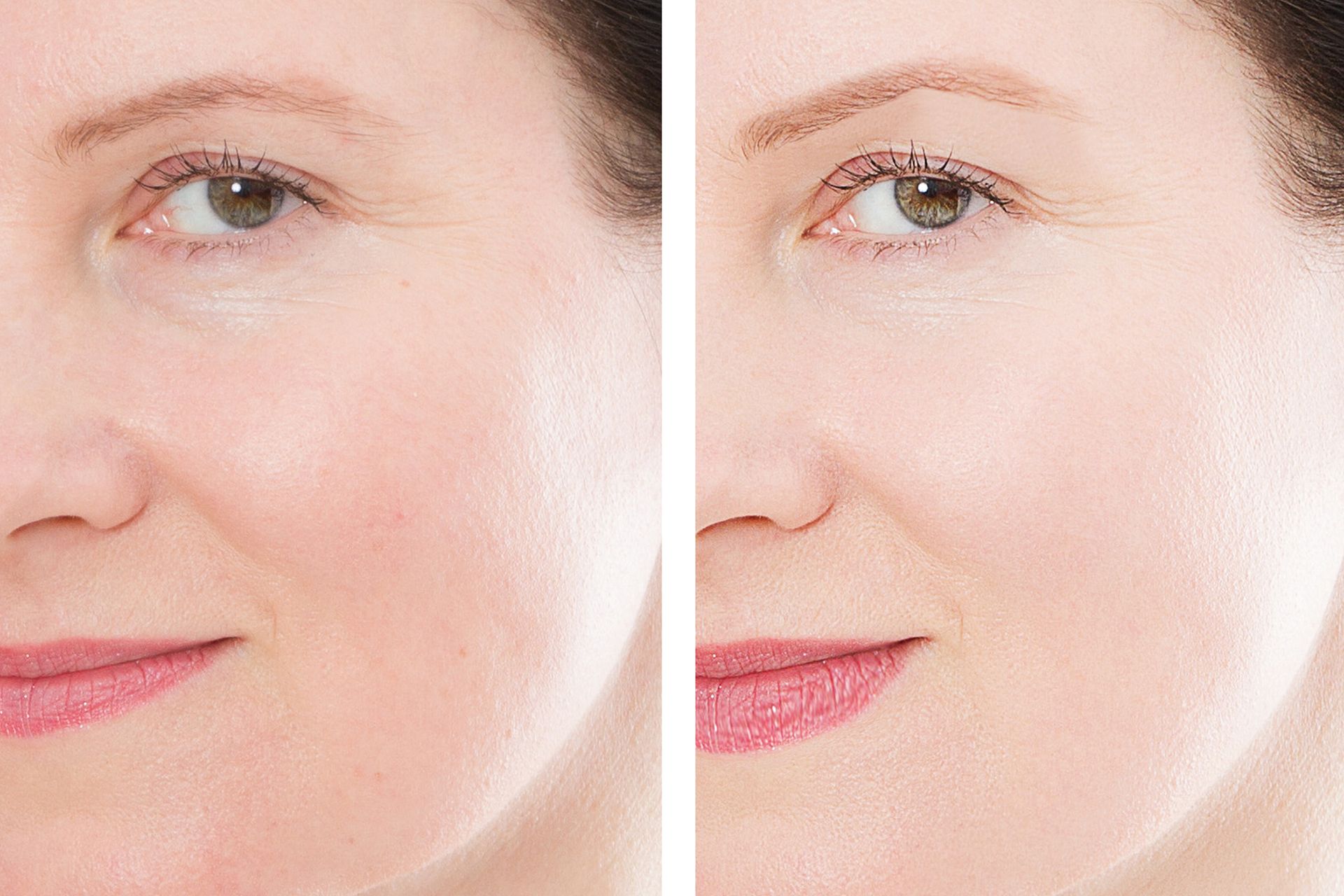 A before and after photo of a woman 's face with and without makeup. A before and after photo of a woman 's face with and without makeup.