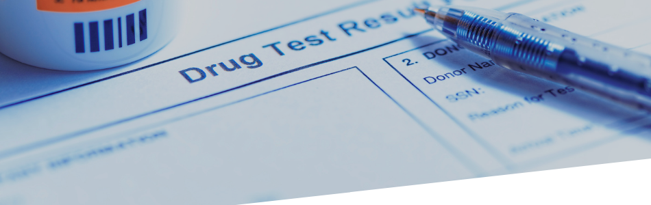 Test droghe su capello e urine