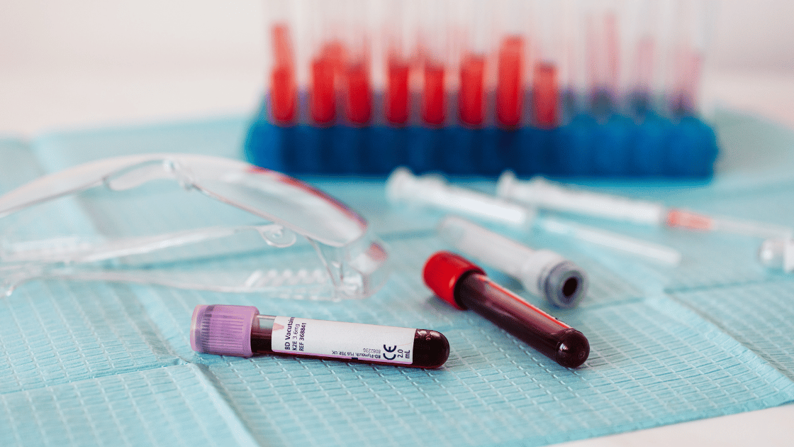 Esame dell'emocromo: cos'è, valori normali e come eseguire l’esame del sangue