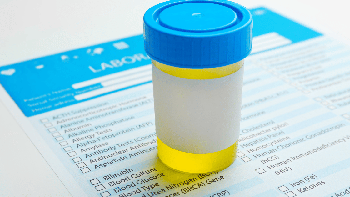 Cos'è la Microalbuminuria, valori normali e come eseguire l’esame del sangue