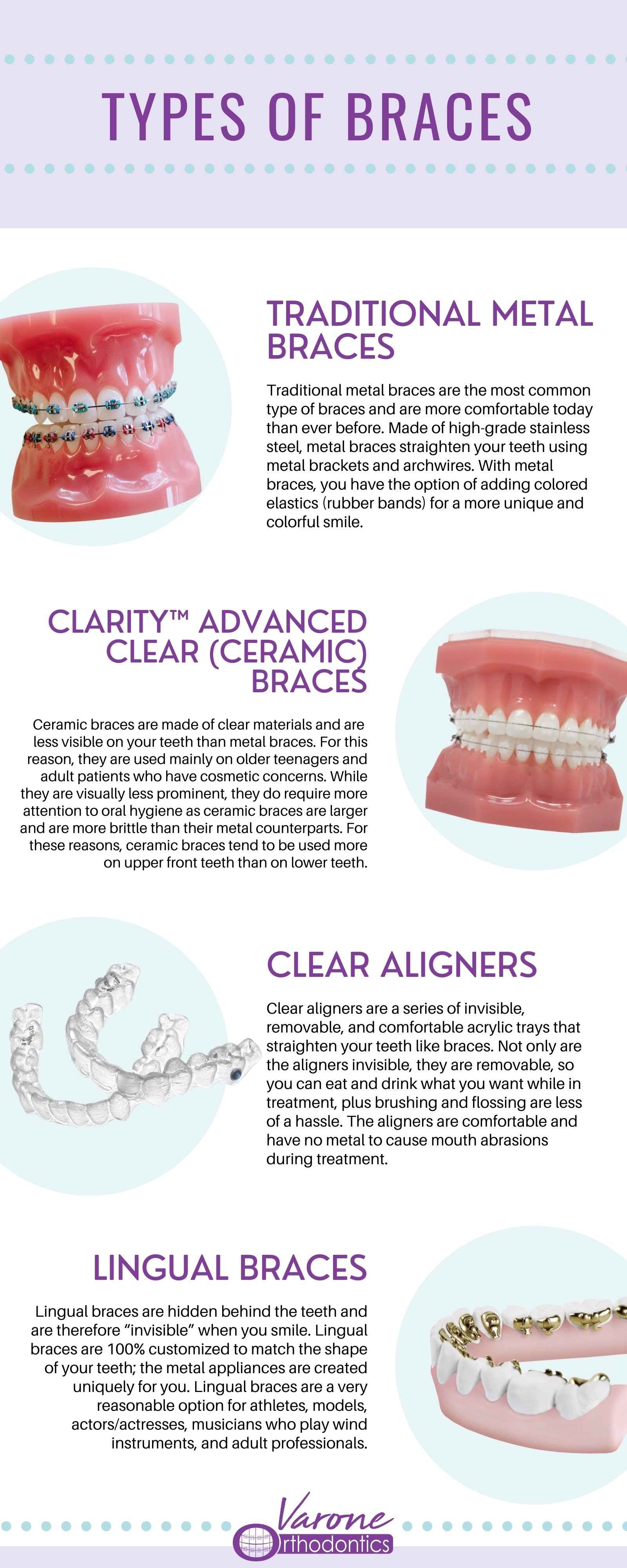 Types of Braces