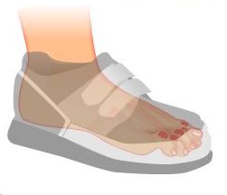 Un primo piano del piede di una persona che indossa una scarpa.