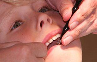 niña en dentista