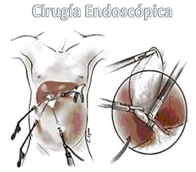 Un dibujo de un hígado siendo operado con las palabras 