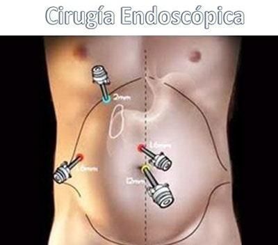 cirugia