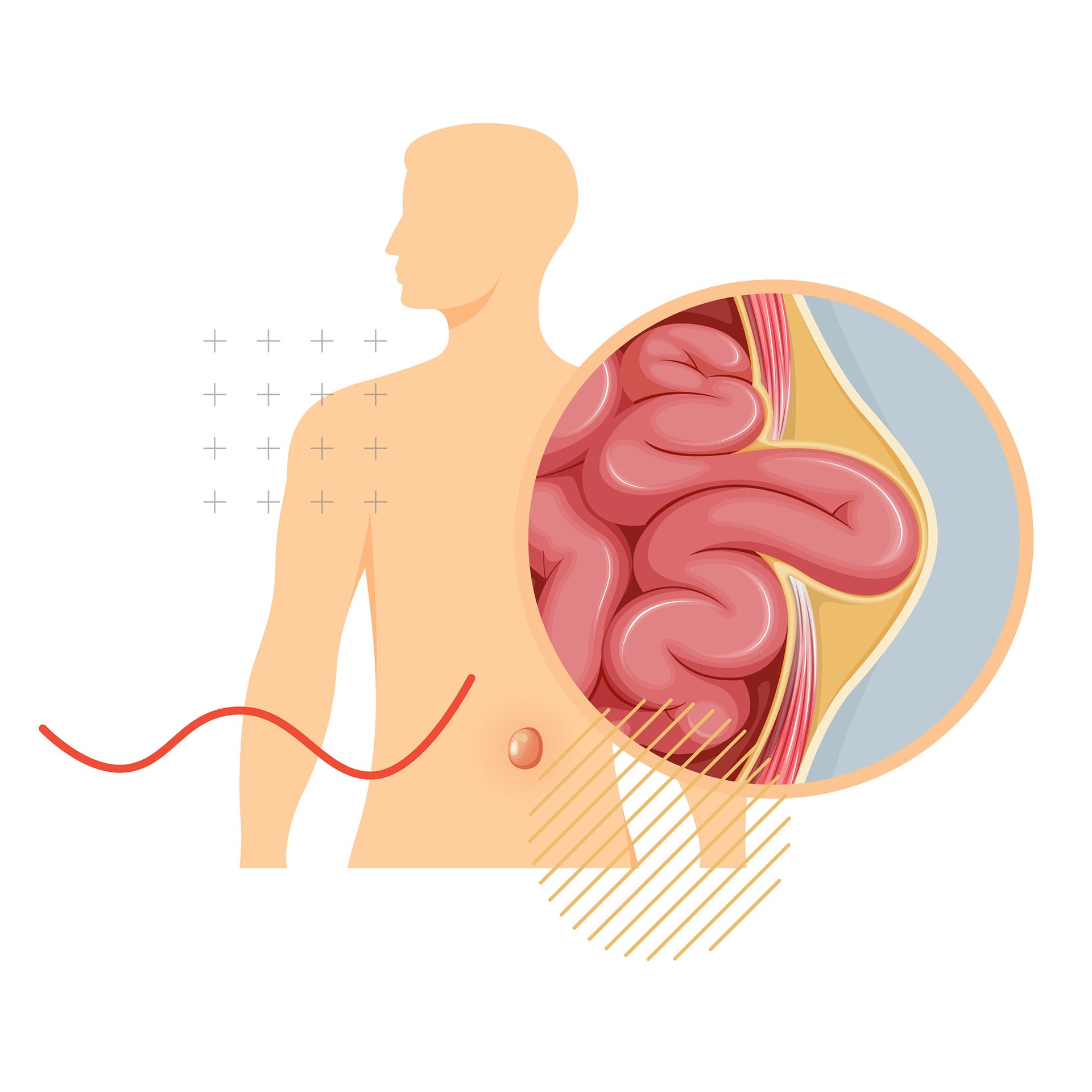 Una ilustración de dibujos animados del estómago y los intestinos de un hombre.