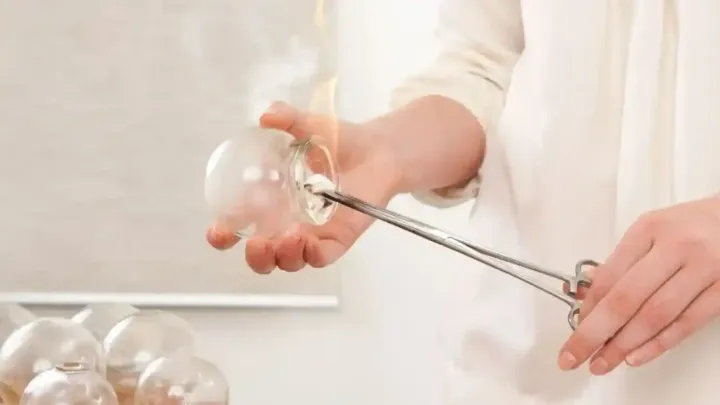 e Register Nurse ,CQC certificated provide Fire Cupping Therapy , in London clinic Marylebone area