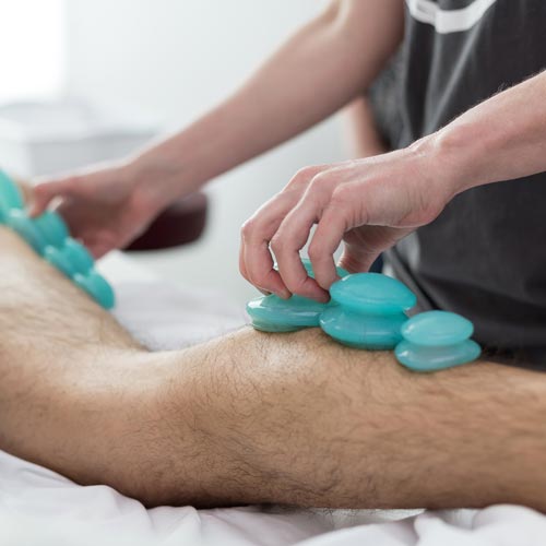 A man is getting a massage with blue cups on his leg.