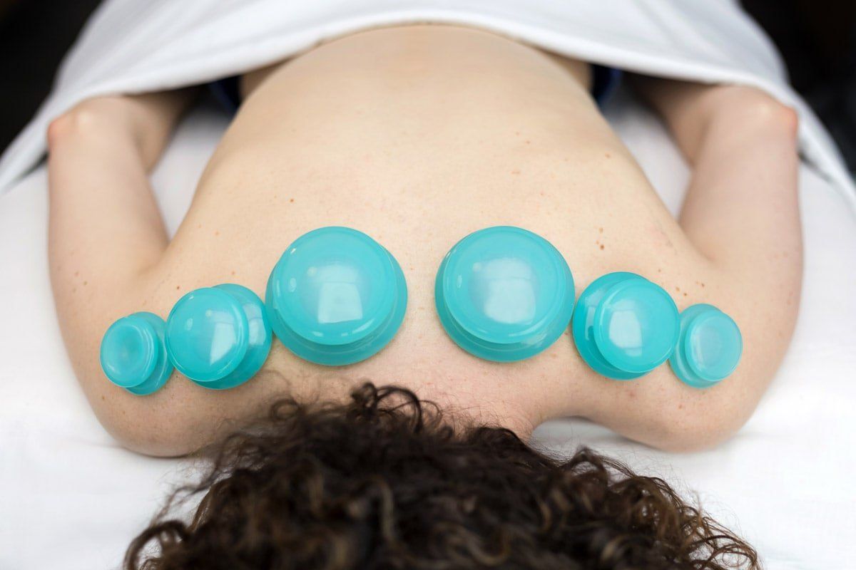 A woman is laying on a table with blue cups on her back.