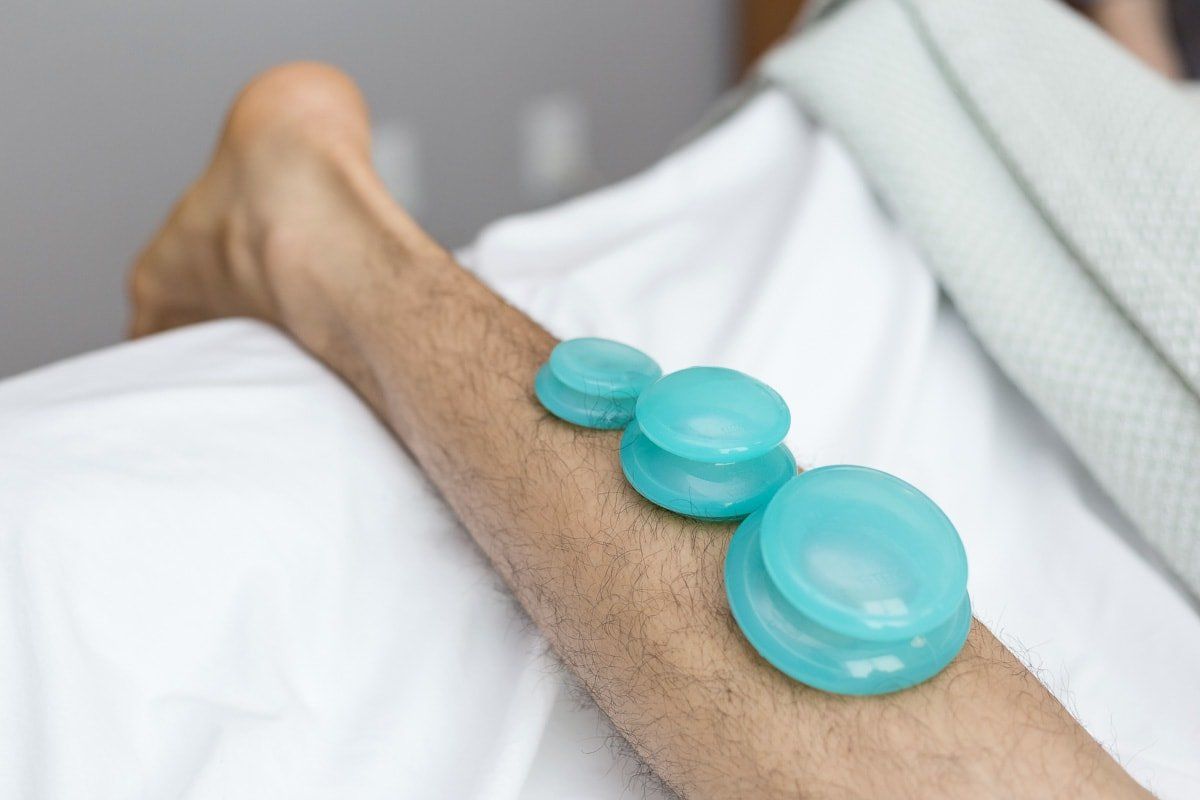 A person is laying on a bed with cupping cups on their leg.