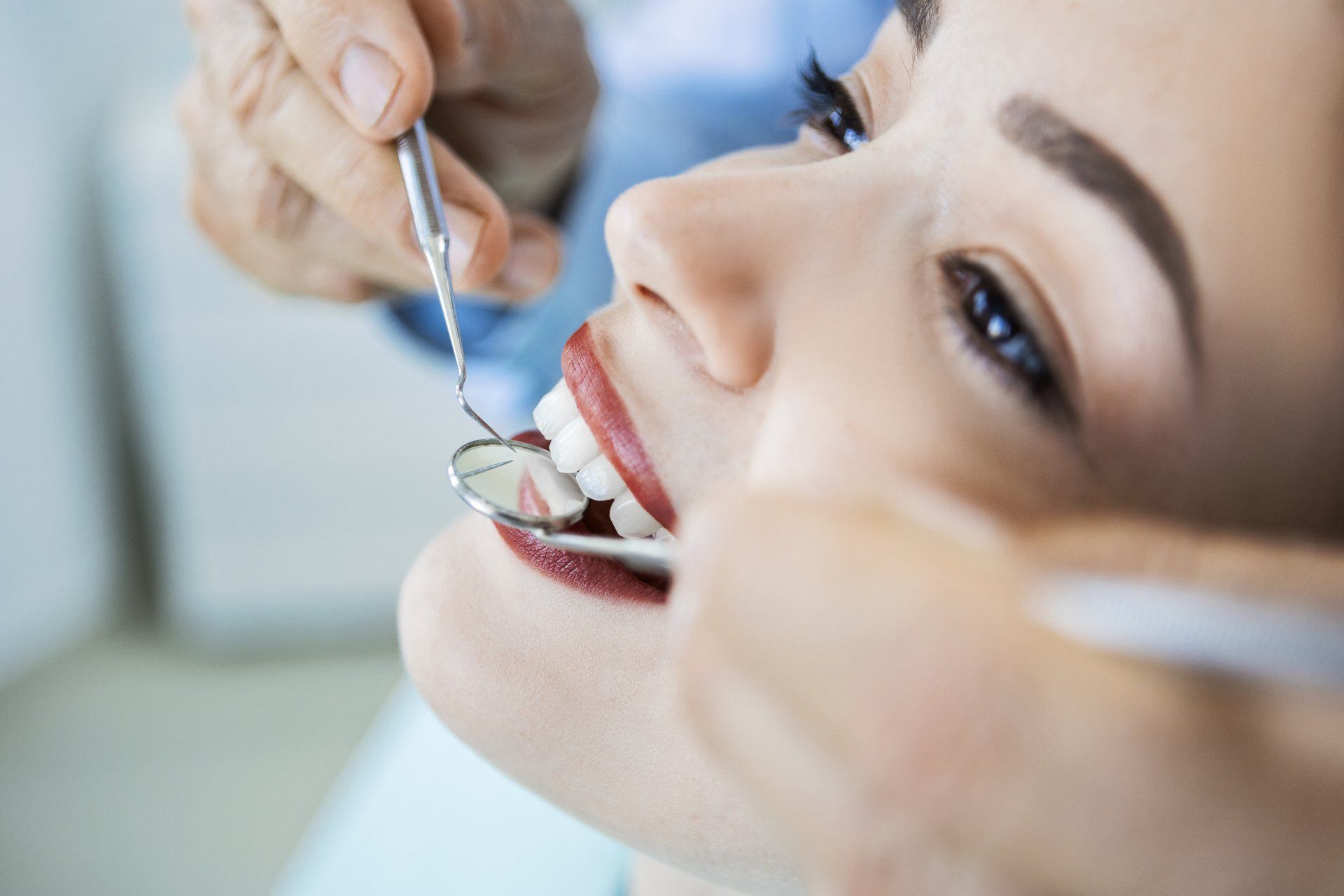 sbiancamento dentale
