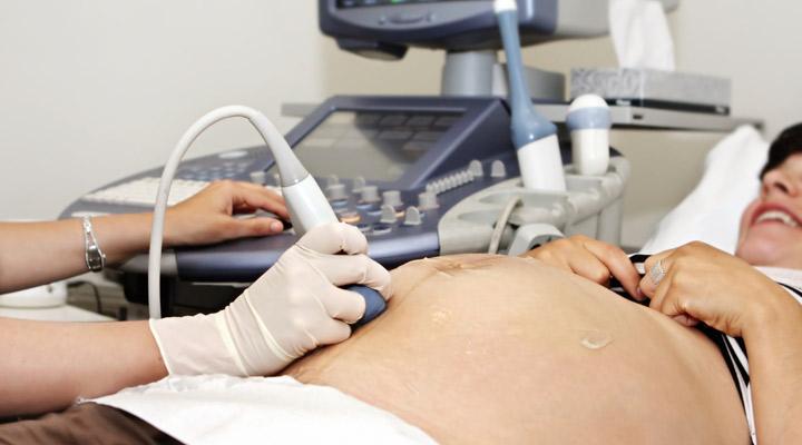 UNIDAD DE GINECOLOGIA Y OBSTETRICIA - Control del embarazo