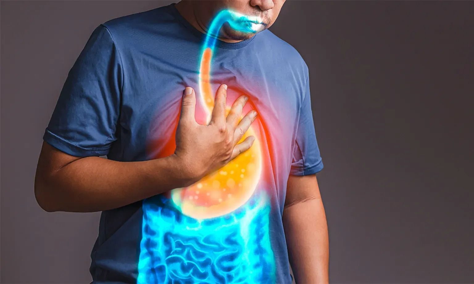 Transoral Incisionless Fundoplication (TIF)