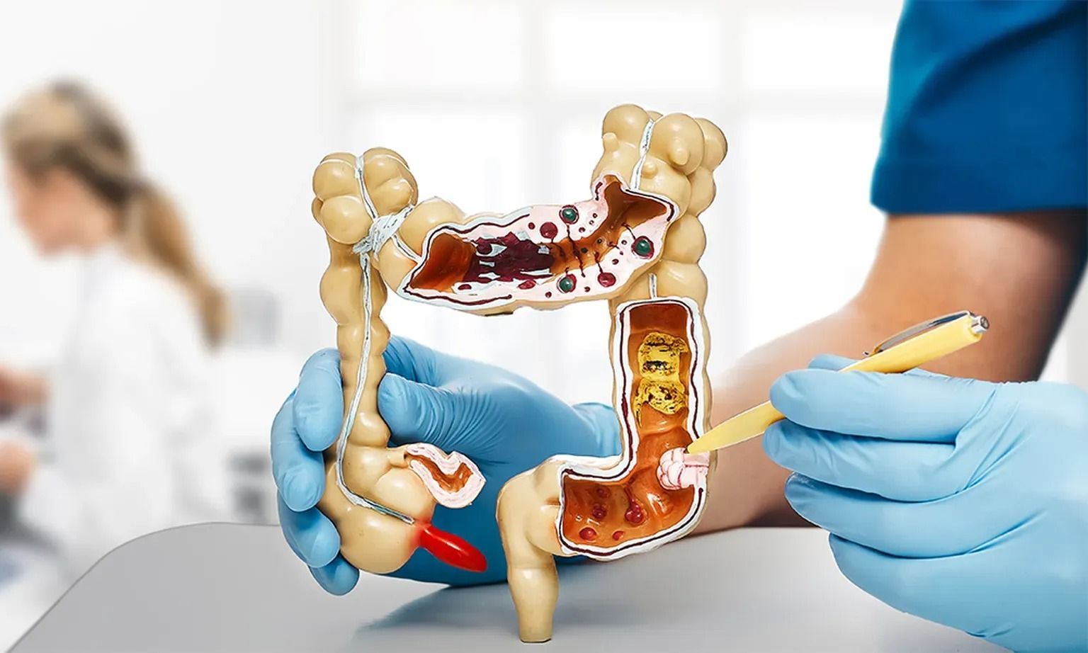 Colon Cancer Screening