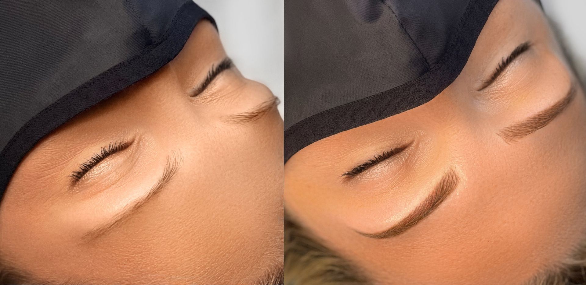 Before and after photos of eyebrows after a cosmetic procedure.