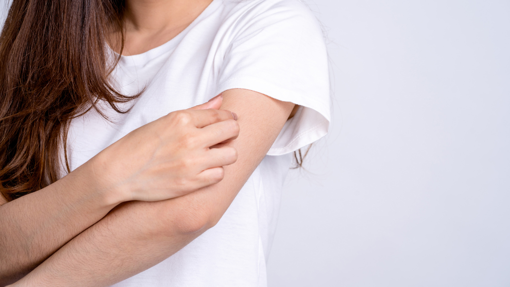 What Does a Spider Bite Look Like?