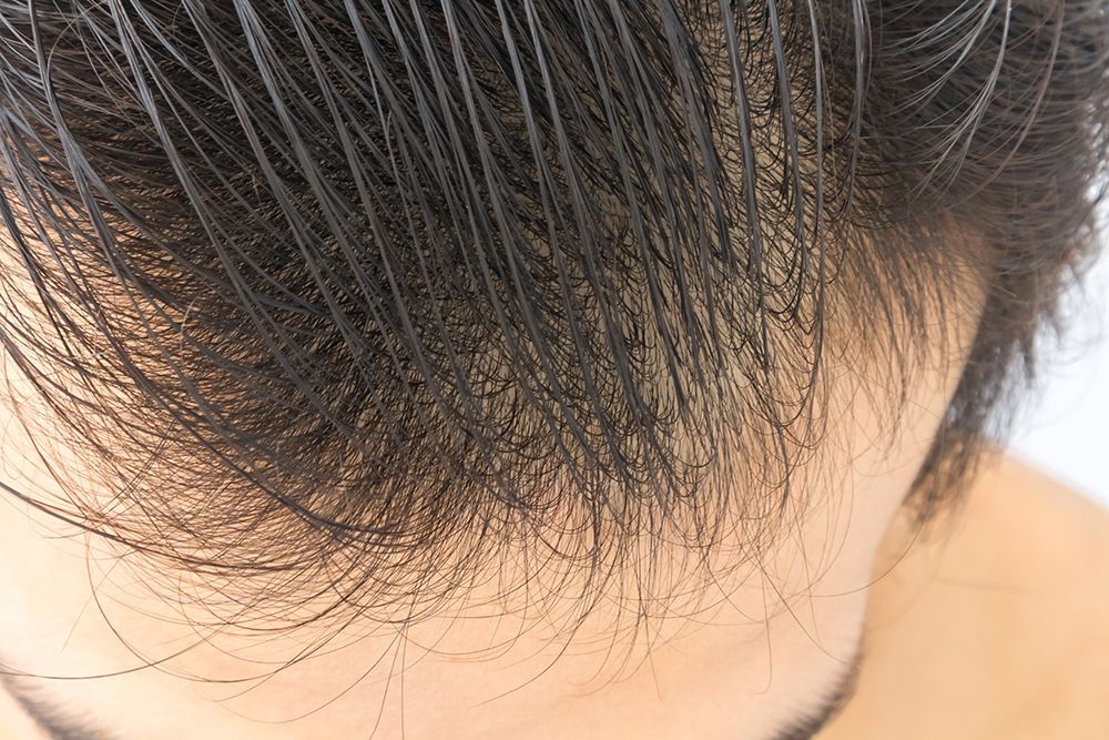 the back of a man's head with hair on top of it