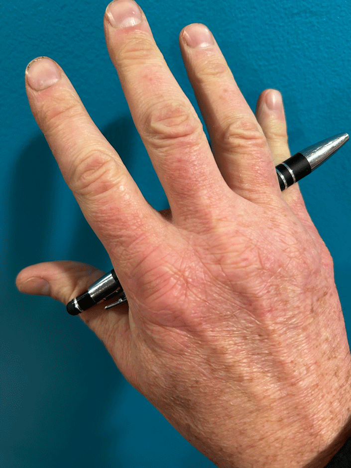 The back of a hand holding a pen as a weapon, against a blue background.