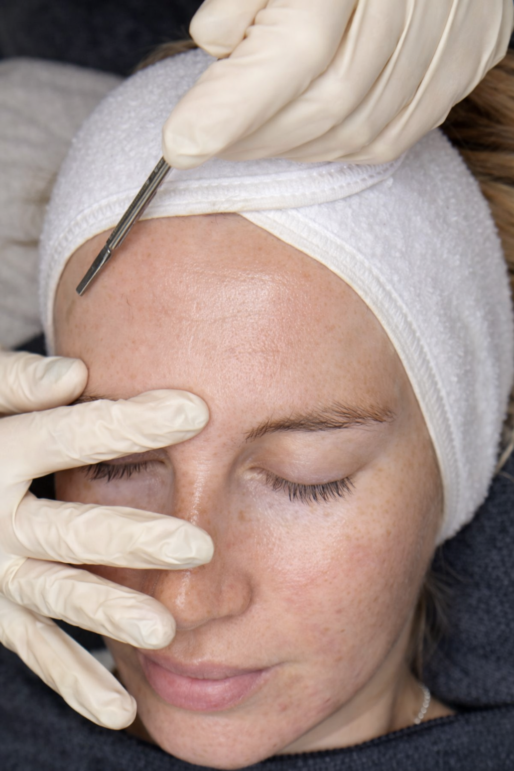 a client getting a dermaplaning treatment