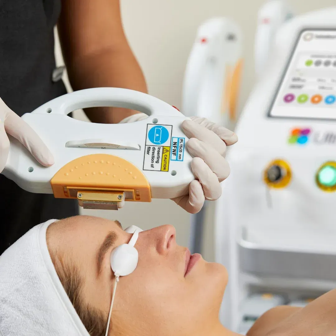 a woman getting an IPL treatment
